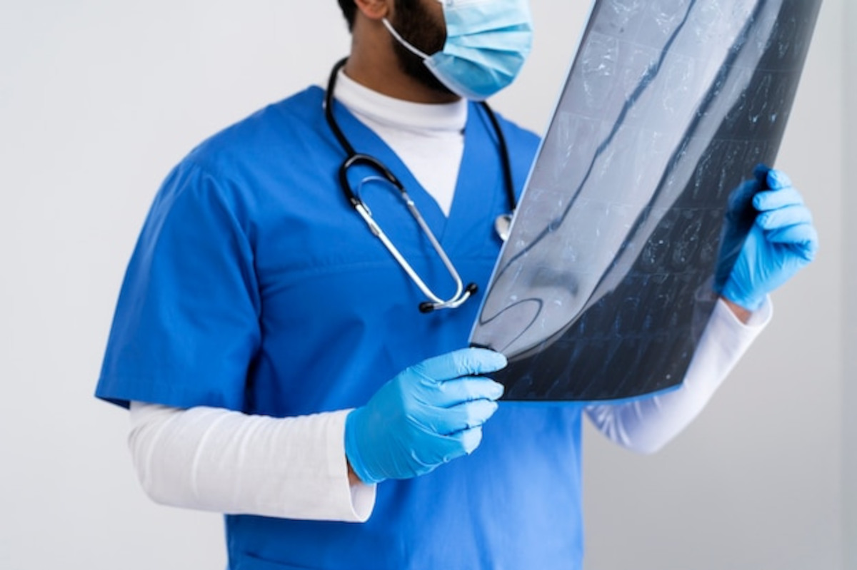 fracture vertebrale