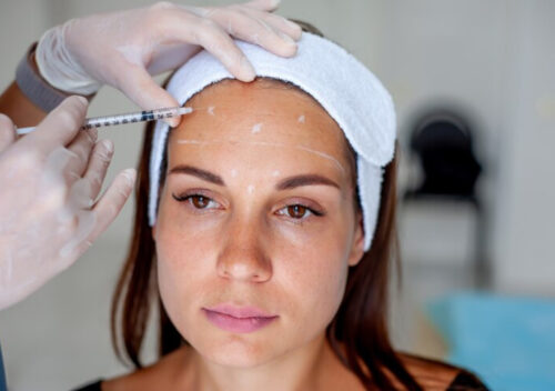 Wrinkle Power Filling